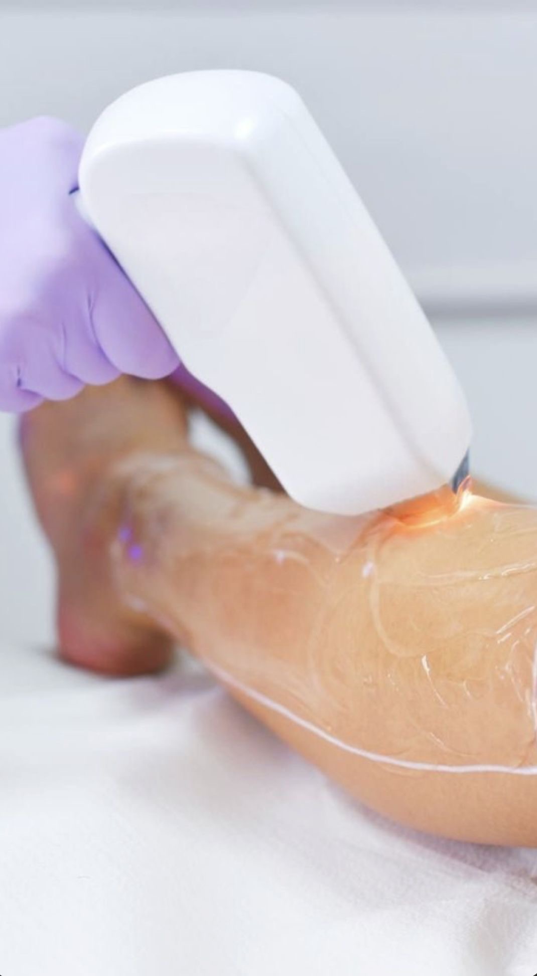 Laserhandstuk op het been, close-up