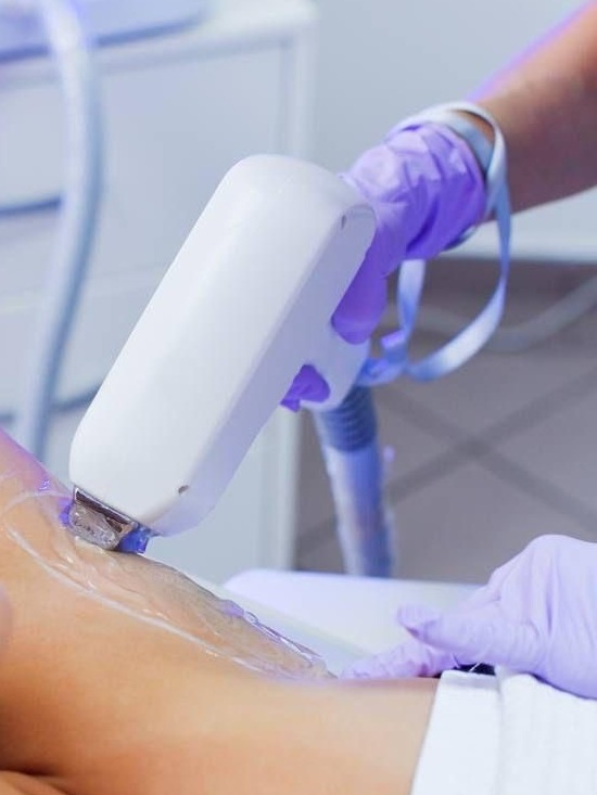 Laserontharing van de oksel